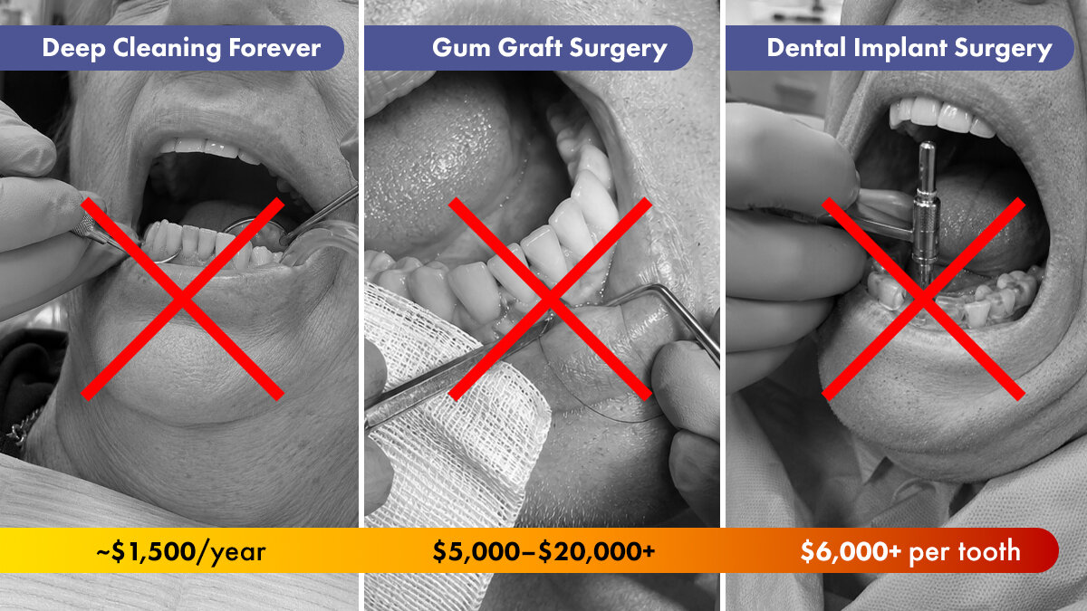 What Fixing Your Gums Really Costs in the UK